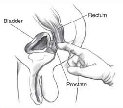 Prostate massage