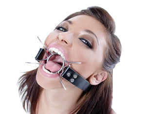Spider mouth gag